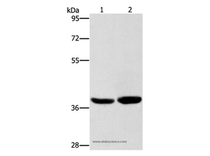 CAB39L Polyclonal Antibody