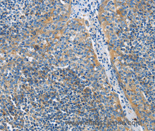 CD272 Polyclonal Antibody