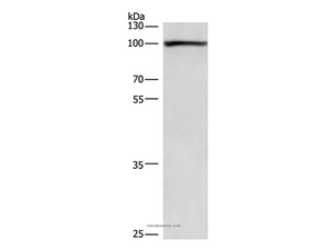 cPLA2 Polyclonal Antibody