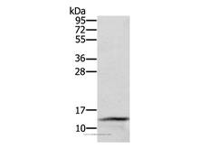 CST2 Polyclonal Antibody
