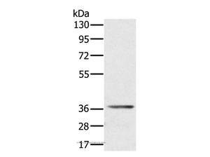 AKR1C4 Polyclonal Antibody