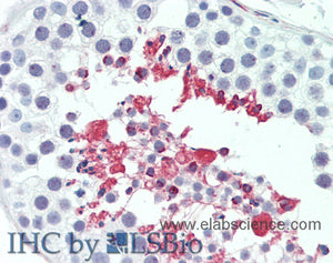 LIPE Polyclonal Antibody