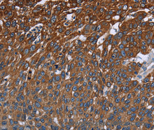 FCGR3A Polyclonal Antibody
