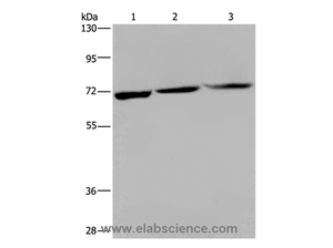KLHL1 Polyclonal Antibody