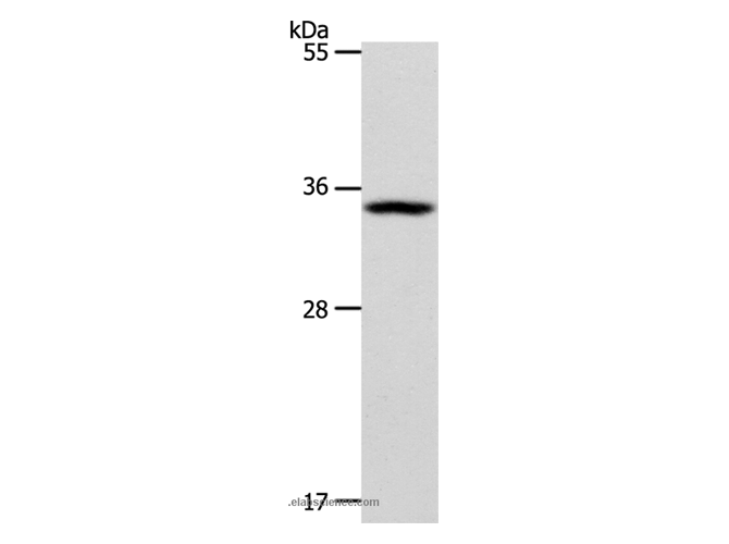 BUD23 Polyclonal Antibody