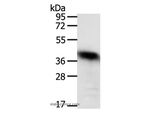 WDR74 Polyclonal Antibody