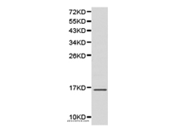 SH2D1A Polyclonal Antibody