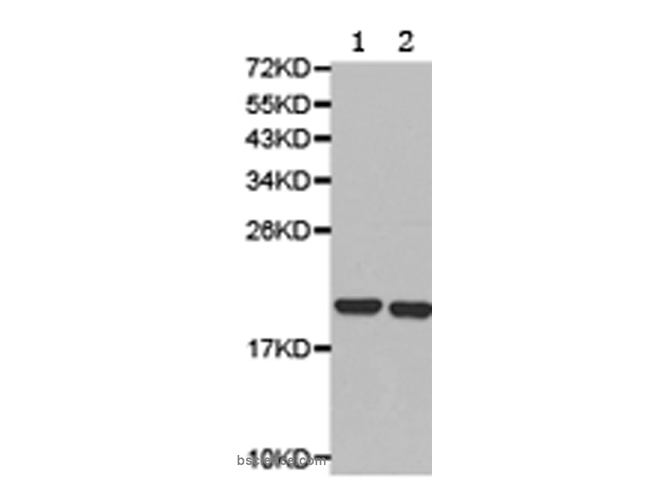 KCNE1 Polyclonal Antibody