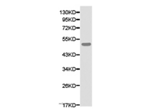 ATXN3 Polyclonal Antibody