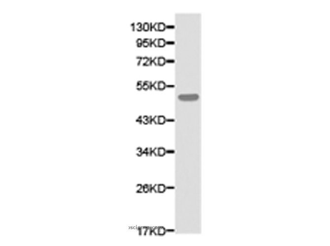 ATXN3 Polyclonal Antibody