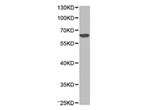 SLC22A5 Polyclonal Antibody