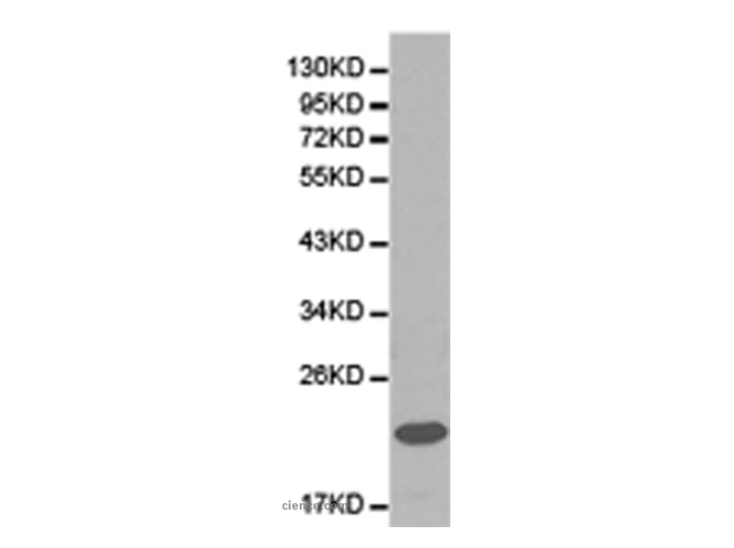 FXN Polyclonal Antibody
