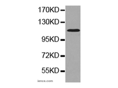 DNA Ligase3 Polyclonal Antibody