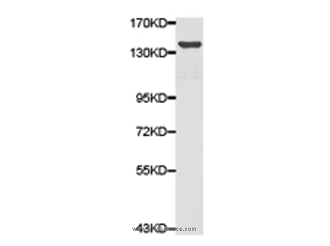 TYK2 Polyclonal Antibody
