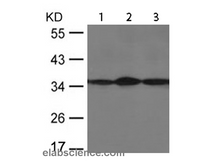 EIF2 alpha Polyclonal Antibody