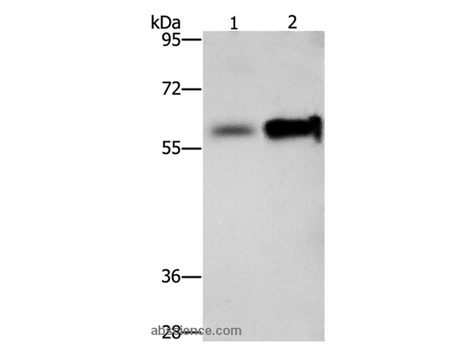 ZBTB7A Polyclonal Antibody