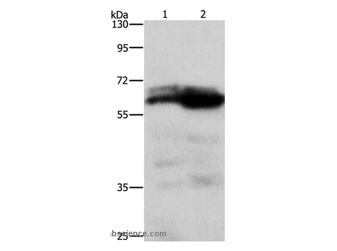 ZDHHC17 Polyclonal Antibody