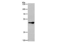 ZIC3 Polyclonal Antibody