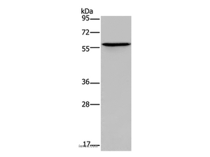 ADRA1B Polyclonal Antibody