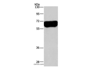 DPYSL3 Polyclonal Antibody