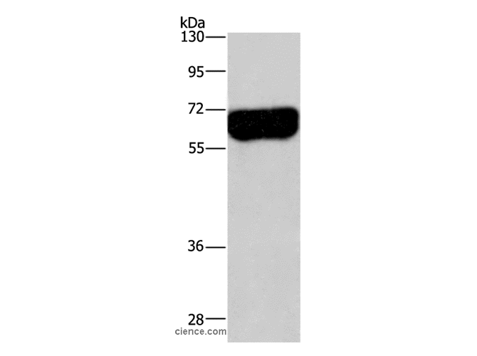 DPYSL3 Polyclonal Antibody