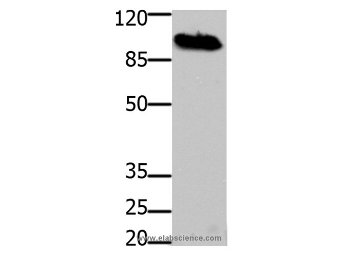DNM1 Polyclonal Antibody