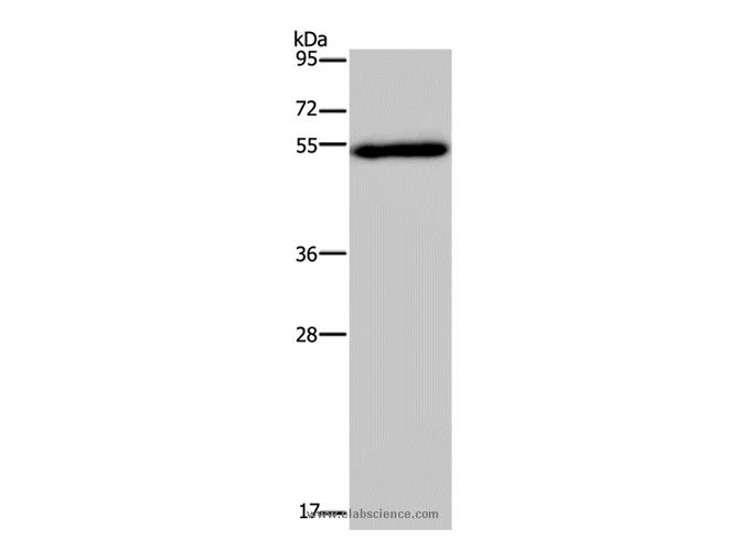 FOXC2 Polyclonal Antibody