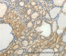 SLC9A3 Polyclonal Antibody