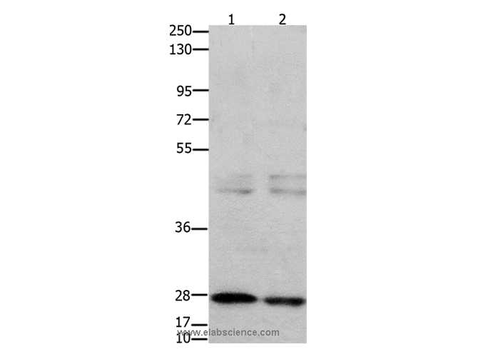GNRHR Polyclonal Antibody