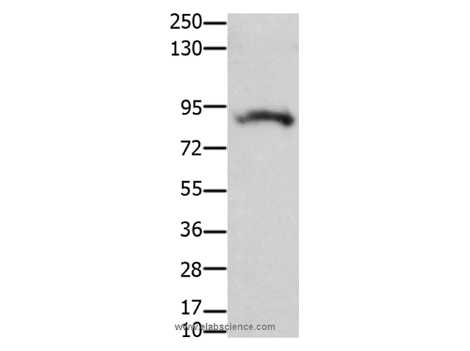 KCNH2 Polyclonal Antibody