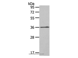 HOXA11 Polyclonal Antibody