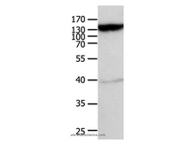 ABCC5 Polyclonal Antibody