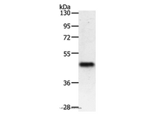 PDK2 Polyclonal Antibody