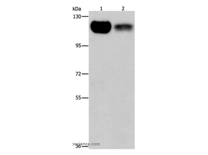 PRKD1 Polyclonal Antibody