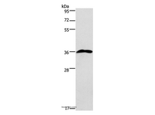 PRPS1/2/PRPS1L1 Polyclonal Antibody