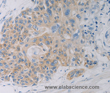 CD303 Polyclonal Antibody