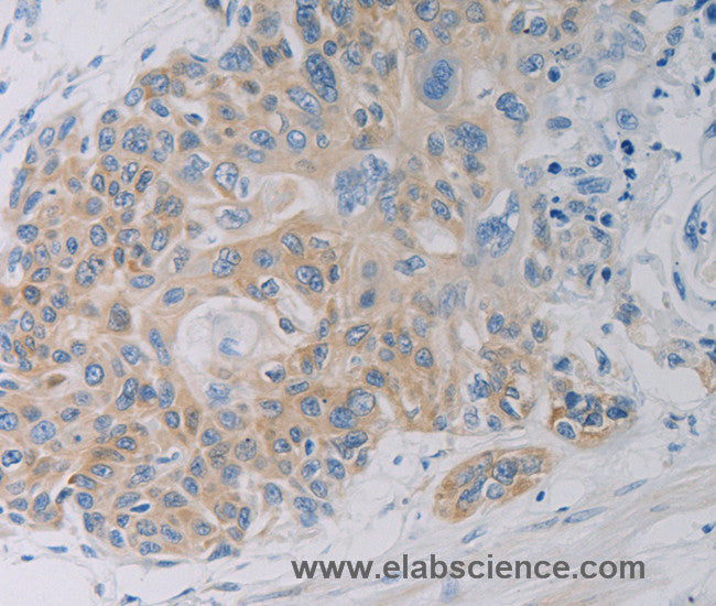CD303 Polyclonal Antibody
