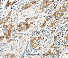 SCN9A Polyclonal Antibody