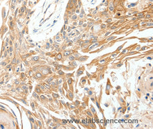 SCN11A Polyclonal Antibody