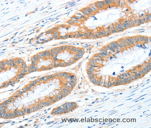 ALDH1A2 Polyclonal Antibody