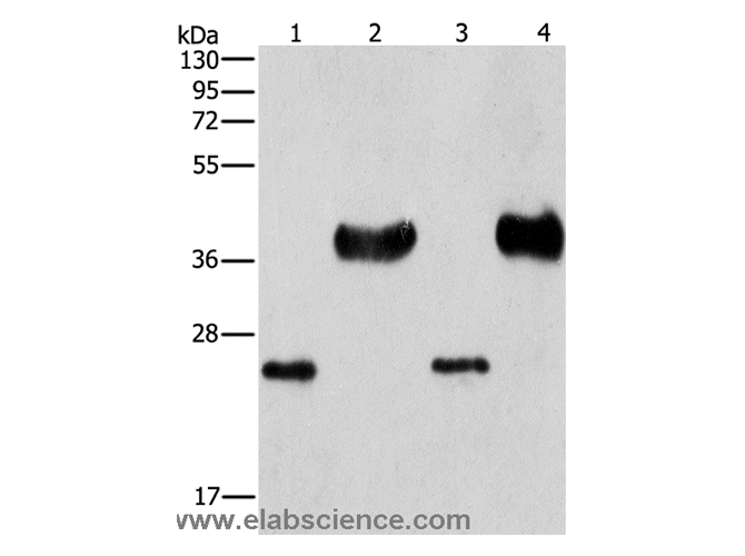 LIN28B Polyclonal Antibody