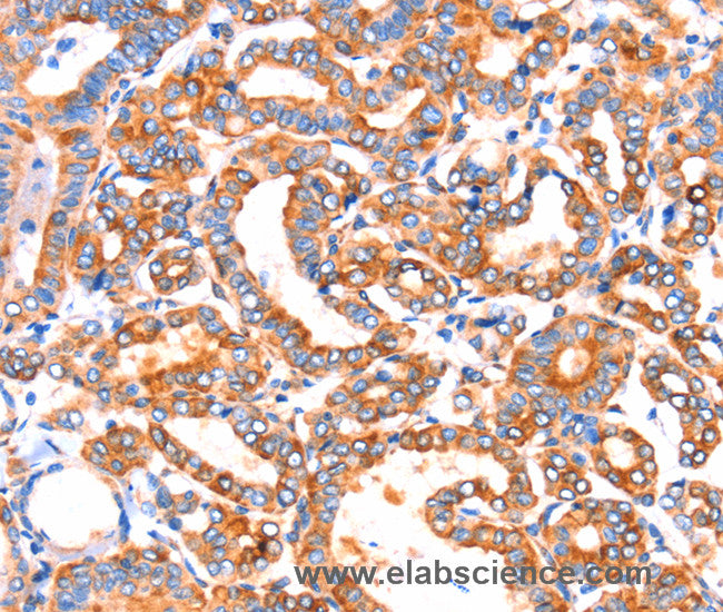 SEPT4 Polyclonal Antibody