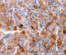 ERN2 Polyclonal Antibody