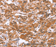 GLMN Polyclonal Antibody