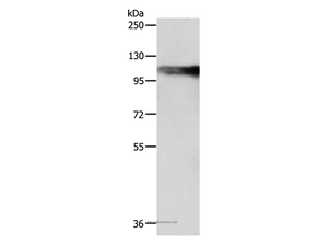AARS2 Polyclonal Antibody
