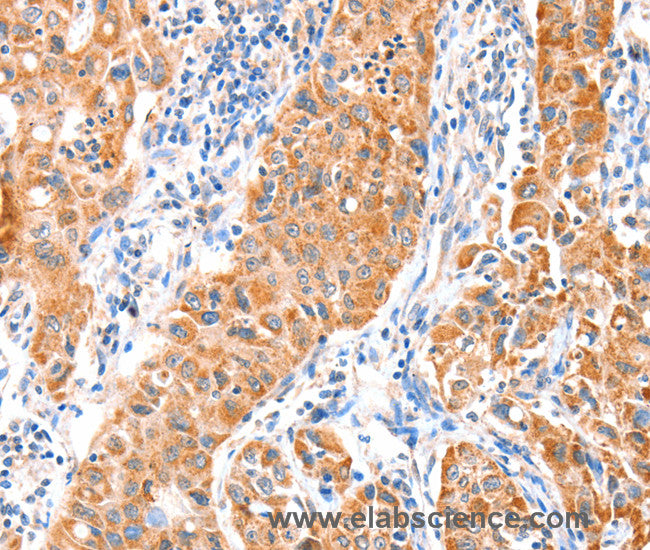 VANGL1 Polyclonal Antibody