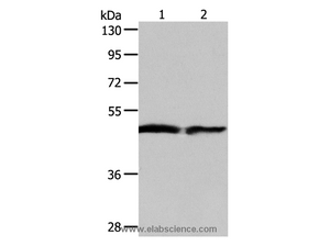AADAC Polyclonal Antibody