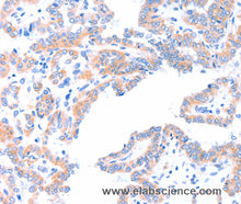 AADACL2 Polyclonal Antibody