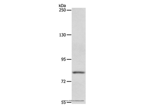 ABCB6 Polyclonal Antibody