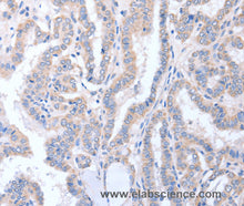 ACTL8 Polyclonal Antibody
